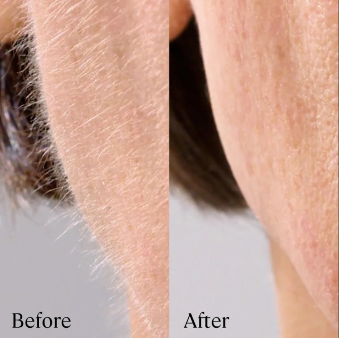 Michael Todd Beauty - Sonicsmooth Pro+ Dermaplaning Blade Refills - 8 Dermaplaning Blades- 2 Month Supply - Device Not Included - Image 5
