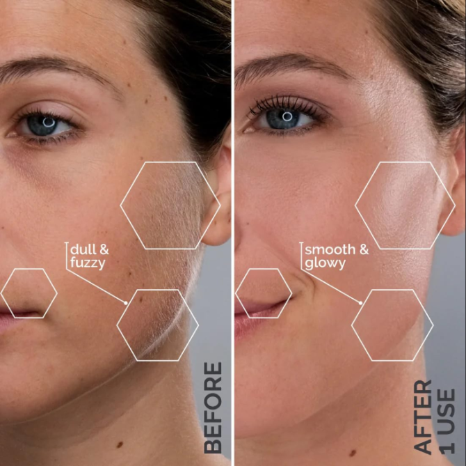 Michael Todd Beauty - Sonicsmooth Pro+ Dermaplaning Blade Refills - 8 Dermaplaning Blades- 2 Month Supply - Device Not Included - Image 3